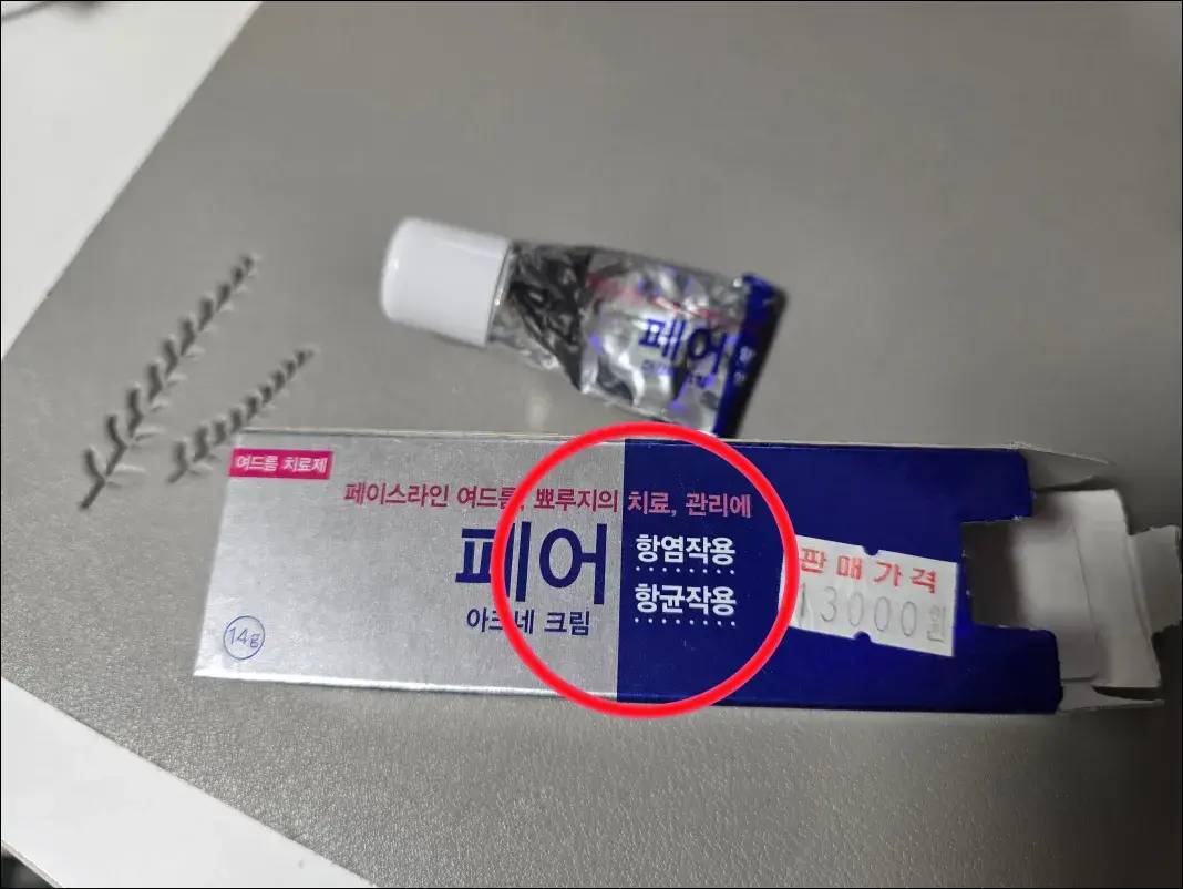 귀-뒤-여드름-관리크림-일반의약품